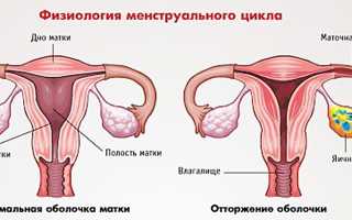 Причины и опасность гипоменструального синдрома