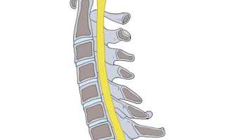 Радикулопатия: разновидности, симптоматика, лечение, профилактика