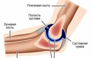 Лечение локтевого сустава: медикаменты, виды, народные средства