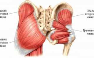 Синдром грушевидной мышцы: что это такое? Причины появления и лечение