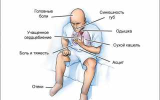 Симптомы и лечение синдрома острой левожелудочковой недостаточности