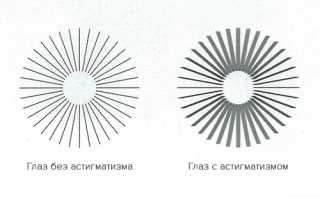 Самая современная диагностика астигматизма: как точно определить заболевание