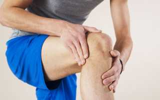 Гонартроз коленного сустава 1 степени: особенности, причины, лечение