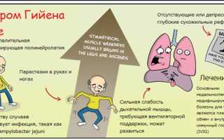 Особенности лечения синдрома Гийена-Барре