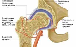 Деформирующий артроз тазобедренного сустава: симптомы и лечение